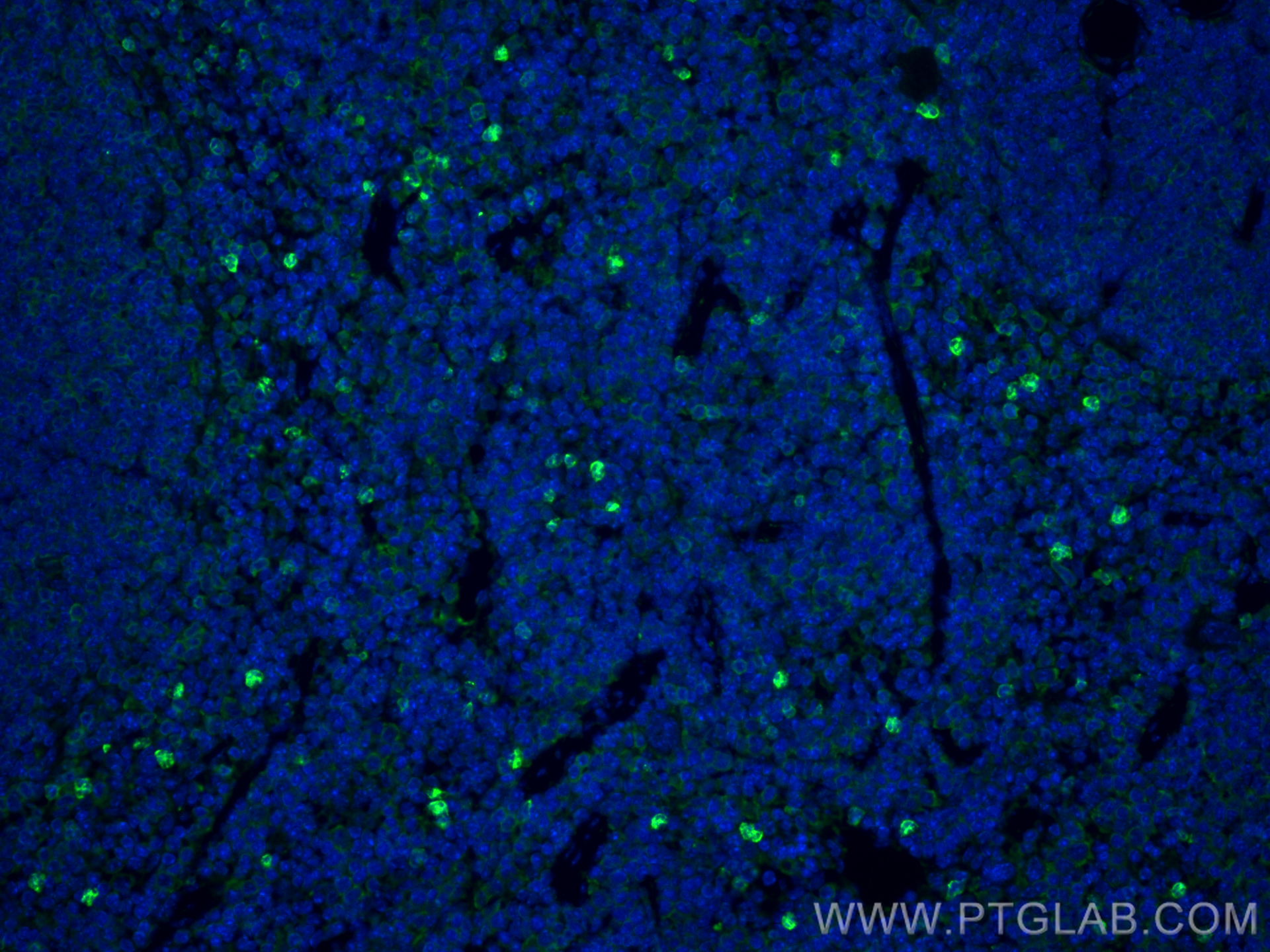 Immunofluorescence (IF) / fluorescent staining of mouse spleen tissue using NOX2 Polyclonal antibody (19013-1-AP)