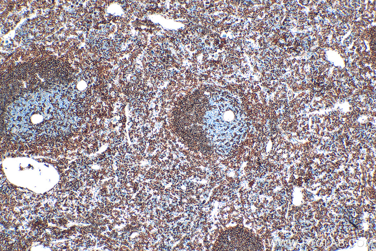 Immunohistochemistry (IHC) staining of mouse spleen tissue using NOX2 Polyclonal antibody (19013-1-AP)