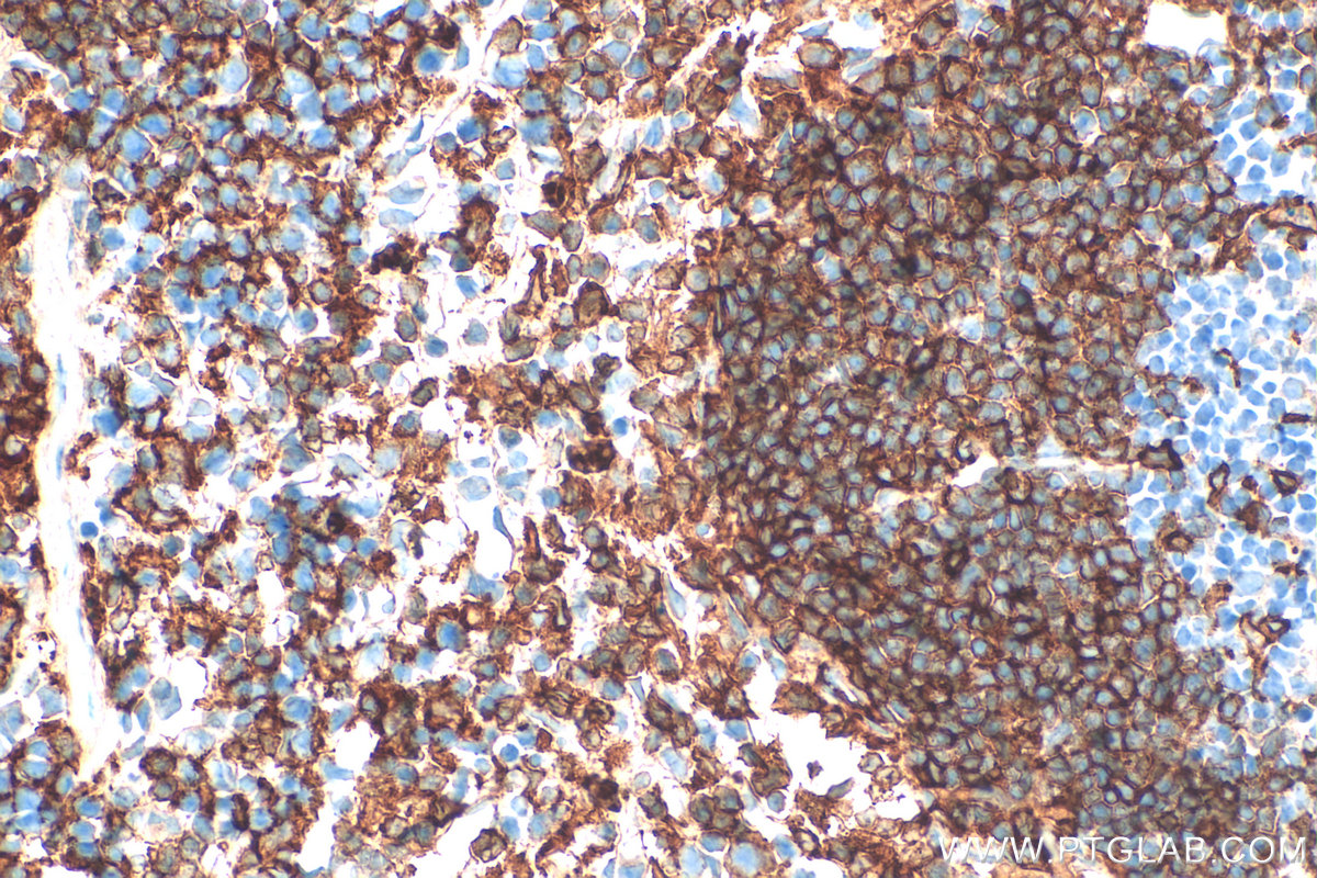 Immunohistochemistry (IHC) staining of mouse spleen tissue using NOX2 Polyclonal antibody (19013-1-AP)