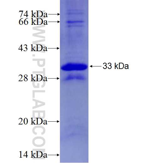 CYFIP1 fusion protein Ag27419 SDS-PAGE