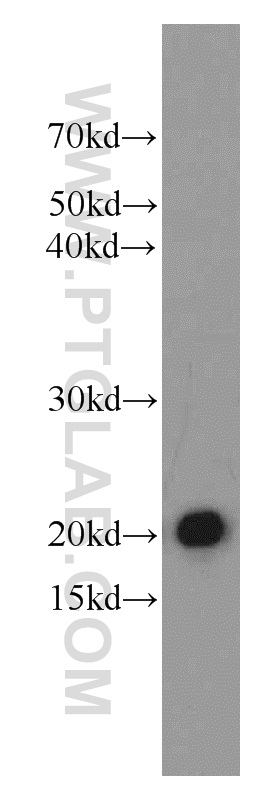 Western Blot (WB) analysis of mouse heart tissue using Cytoglobin Polyclonal antibody (13317-1-AP)
