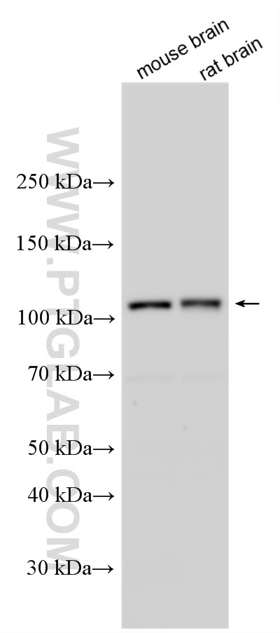 Western Blot (WB) analysis of various lysates using CYLD Polyclonal antibody (11110-1-AP)