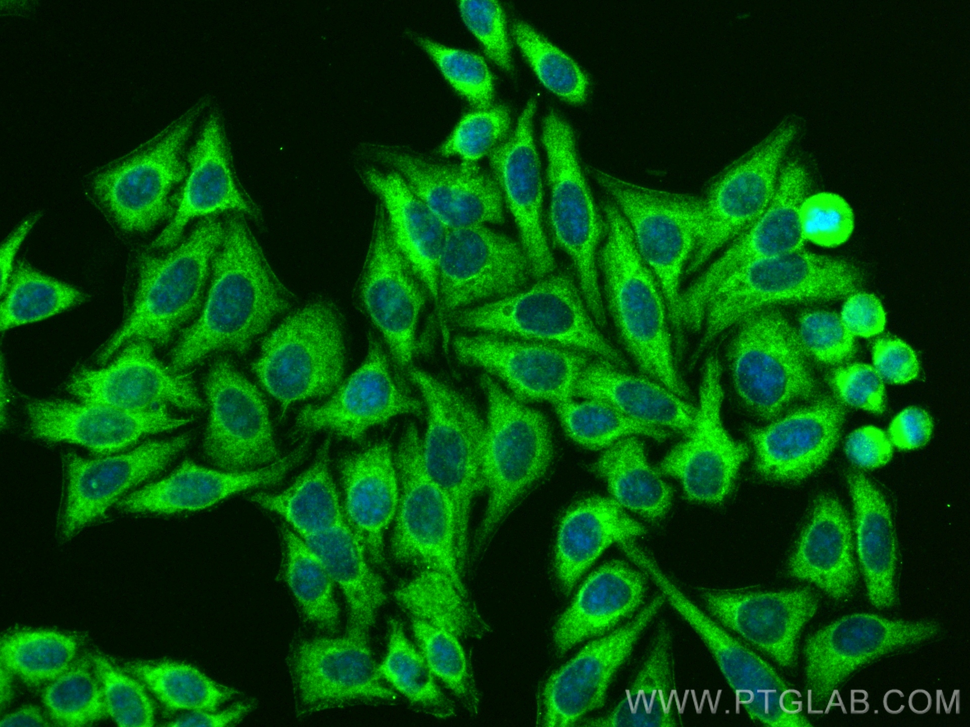 Immunofluorescence (IF) / fluorescent staining of HepG2 cells using CYP11A1 Polyclonal antibody (13363-1-AP)