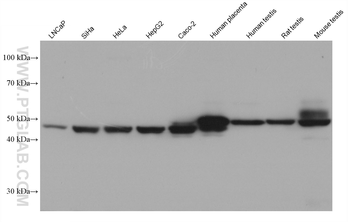 Western Blot (WB) analysis of various lysates using CYP11A1 Monoclonal antibody (67264-1-Ig)