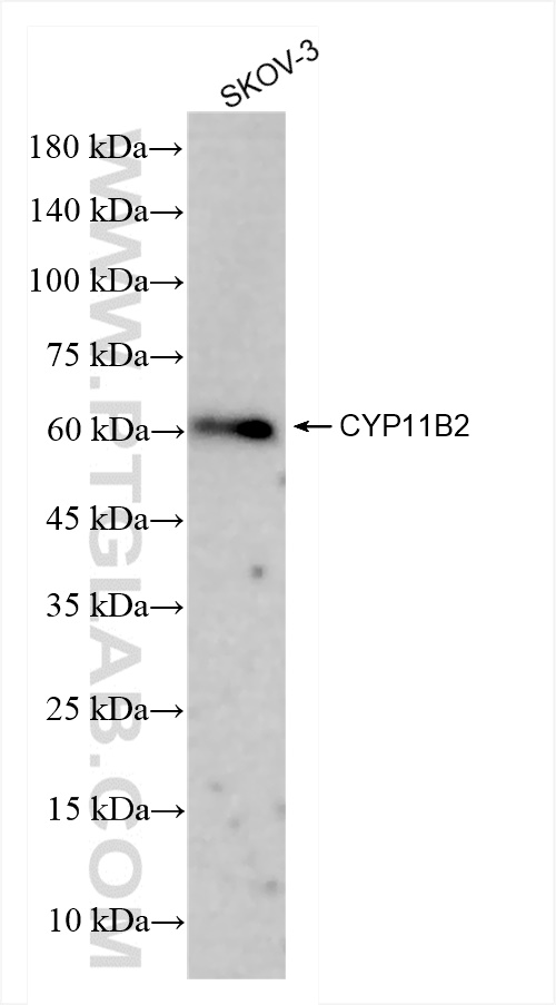 Western Blot (WB) analysis of SKOV-3 cells using CYP11B2 Recombinant antibody (83930-1-RR)