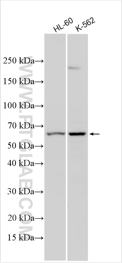 CYP19A1