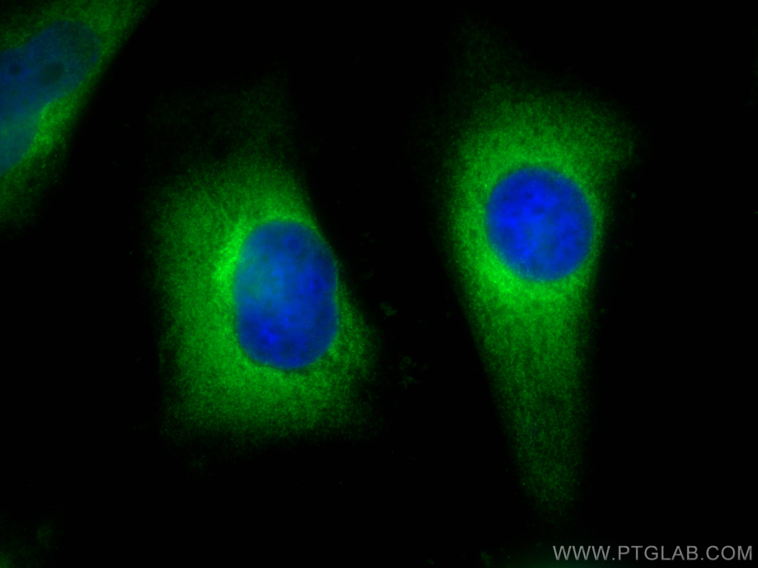 Immunofluorescence (IF) / fluorescent staining of HeLa cells using CYP1A1 Polyclonal antibody (13241-1-AP)