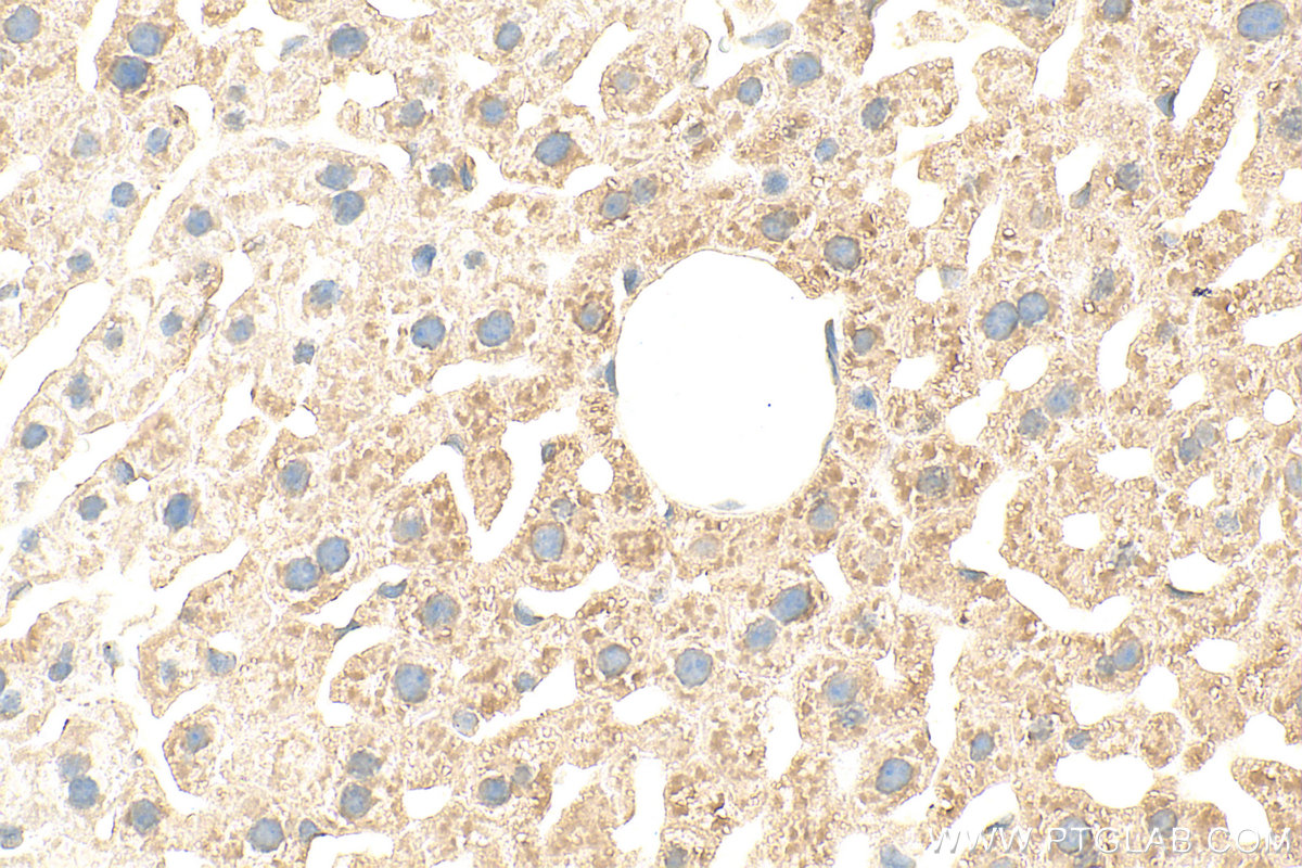 Immunohistochemistry (IHC) staining of mouse liver tissue using CYP1A2-Specific Polyclonal antibody (19936-1-AP)