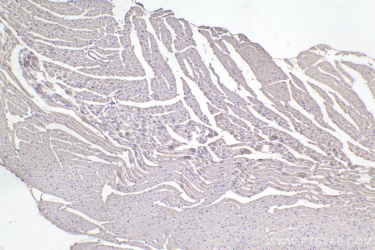 Immunohistochemistry (IHC) staining of mouse heart tissue using CYP1B1 Monoclonal antibody (67033-1-Ig)