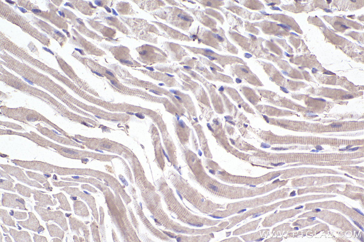 Immunohistochemistry (IHC) staining of mouse heart tissue using CYP1B1 Monoclonal antibody (67033-1-Ig)