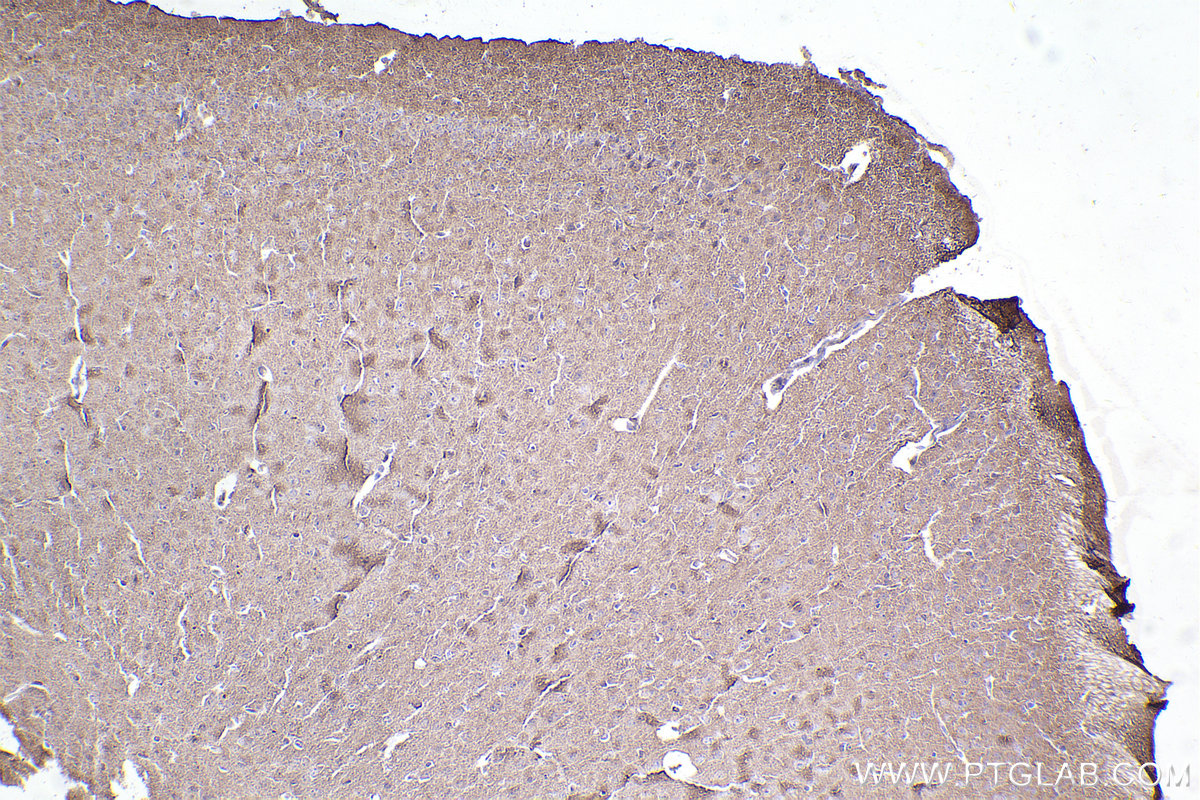 Immunohistochemistry (IHC) staining of mouse brain tissue using CYP1B1 Monoclonal antibody (67033-1-Ig)