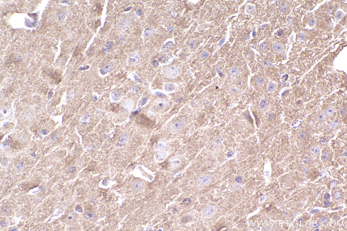 Immunohistochemistry (IHC) staining of mouse brain tissue using CYP1B1 Monoclonal antibody (67033-1-Ig)