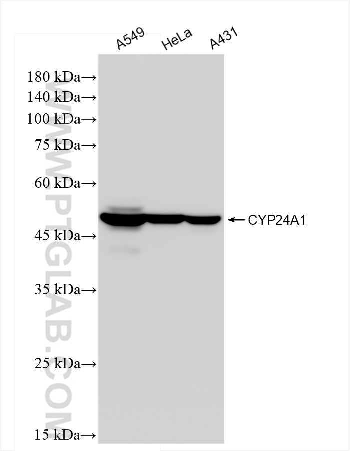 CYP24A1