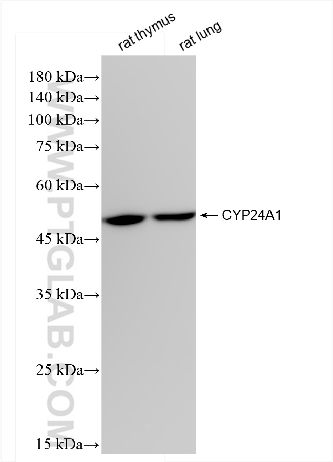 Western Blot (WB) analysis of various lysates using CYP24A1 Recombinant antibody (84821-3-RR)