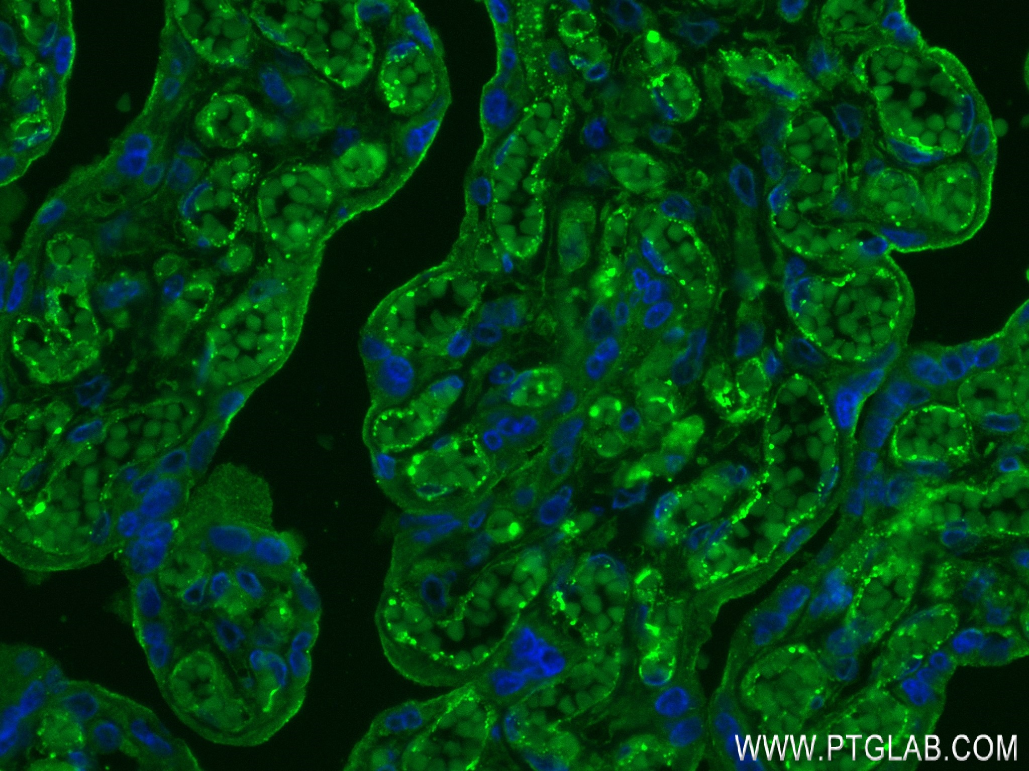 Immunofluorescence (IF) / fluorescent staining of human placenta tissue using CYP26A1 Recombinant antibody (84699-1-RR)