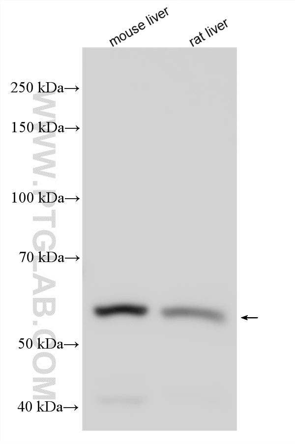Western Blot (WB) analysis of various lysates using CYP27A1 Polyclonal antibody (14739-1-AP)