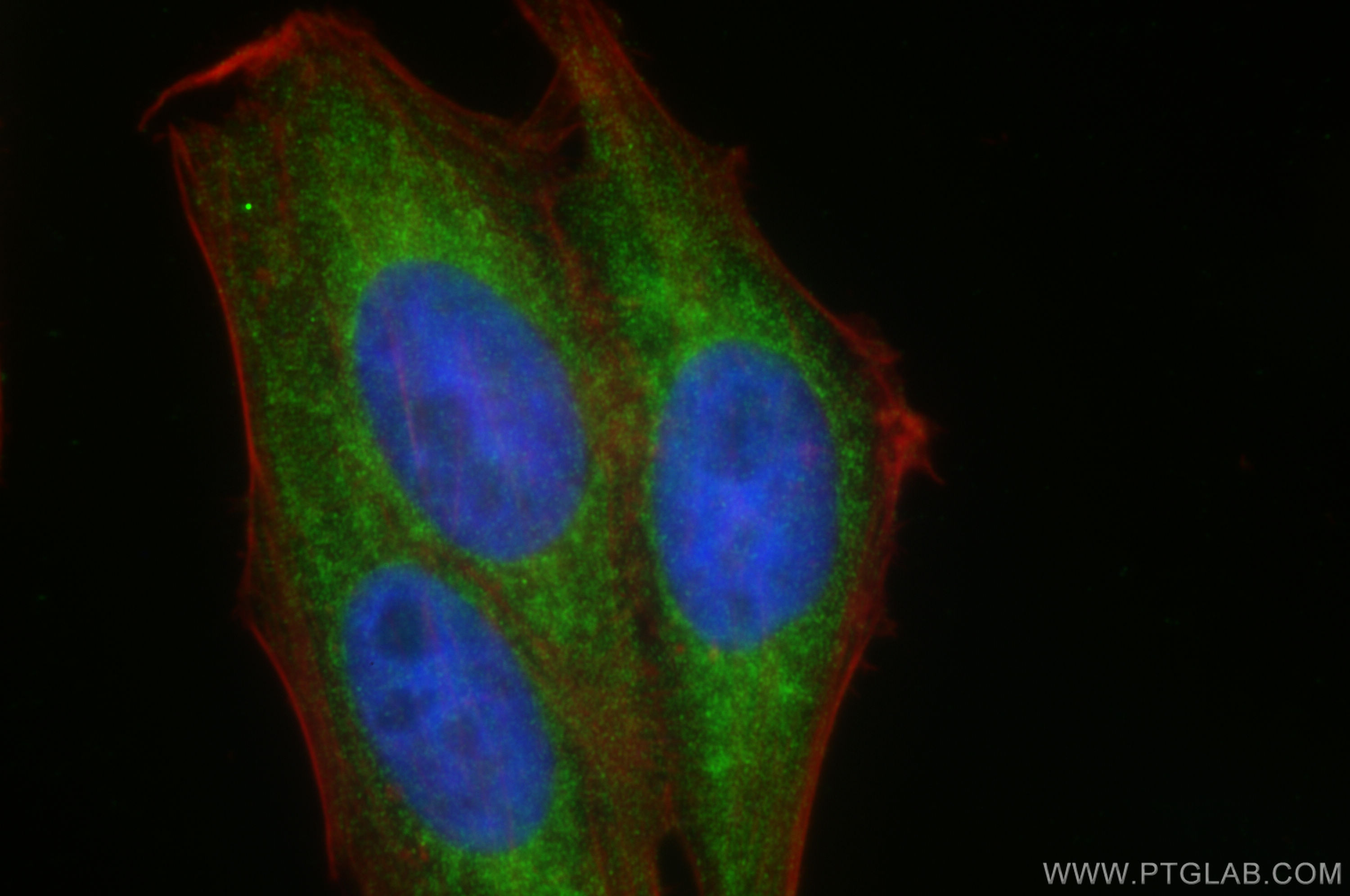 Immunofluorescence (IF) / fluorescent staining of HepG2 cells using CYP2E1-Specific Polyclonal antibody (19937-1-AP)