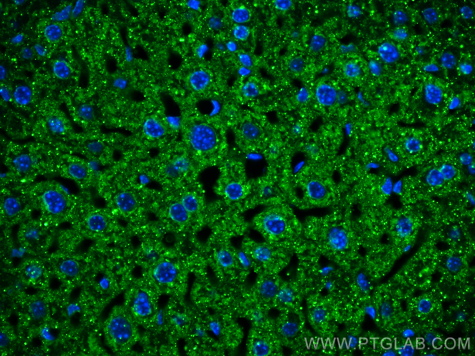 Immunofluorescence (IF) / fluorescent staining of mouse liver tissue using CYP2E1-Specific Monoclonal antibody (67263-1-Ig)