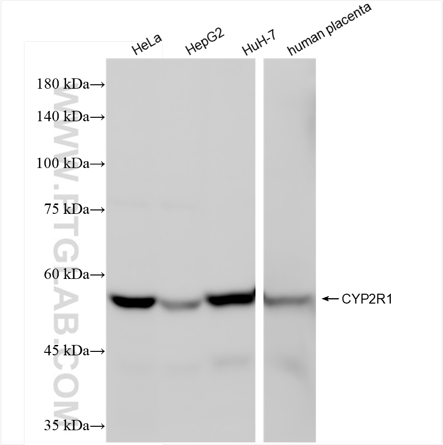 Western Blot (WB) analysis of various lysates using CYP2R1 Recombinant antibody (84378-5-RR)