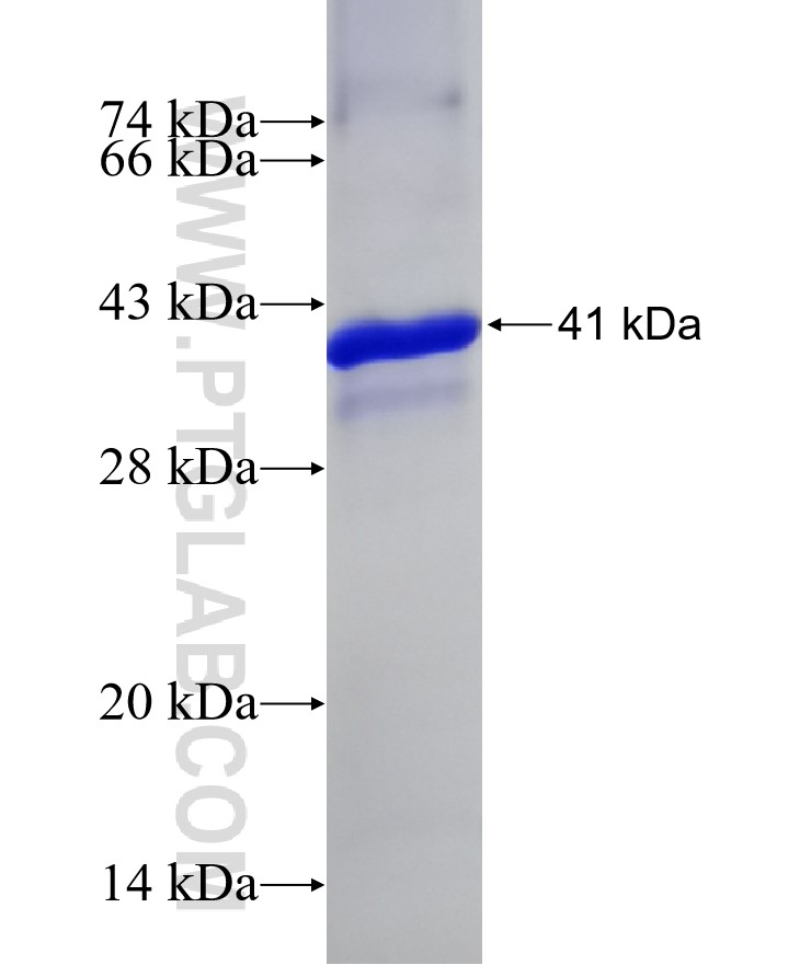 CYP2W1 fusion protein Ag29982 SDS-PAGE