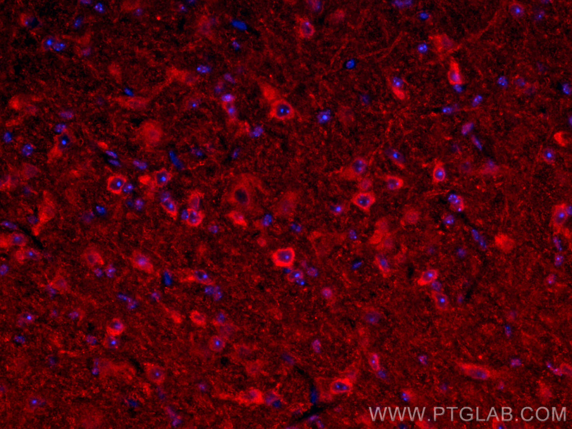 Immunofluorescence (IF) / fluorescent staining of mouse brain tissue using CYP46A1 Polyclonal antibody (12486-1-AP)