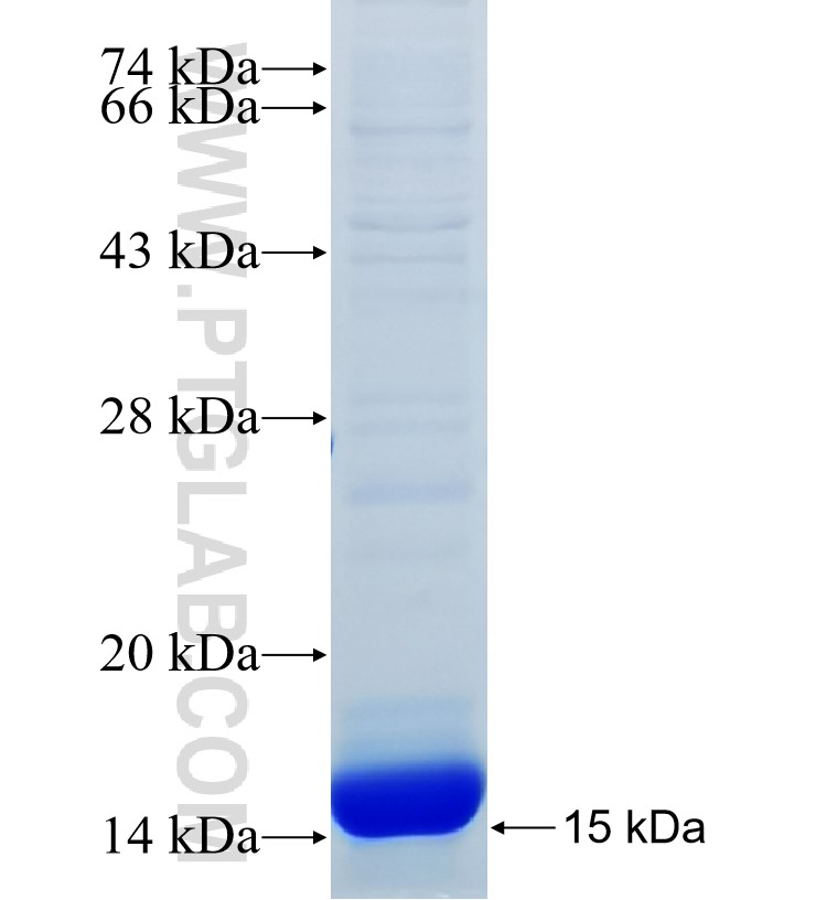 CYP4F2 fusion protein Ag33921 SDS-PAGE