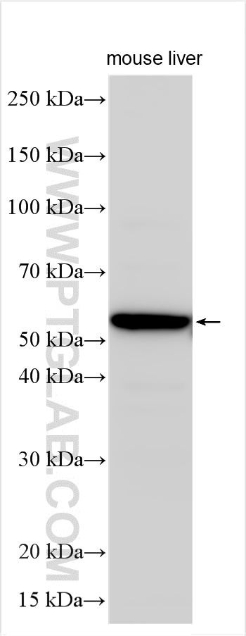 Western Blot (WB) analysis of various lysates using CYP4V2 Polyclonal antibody (13826-1-AP)