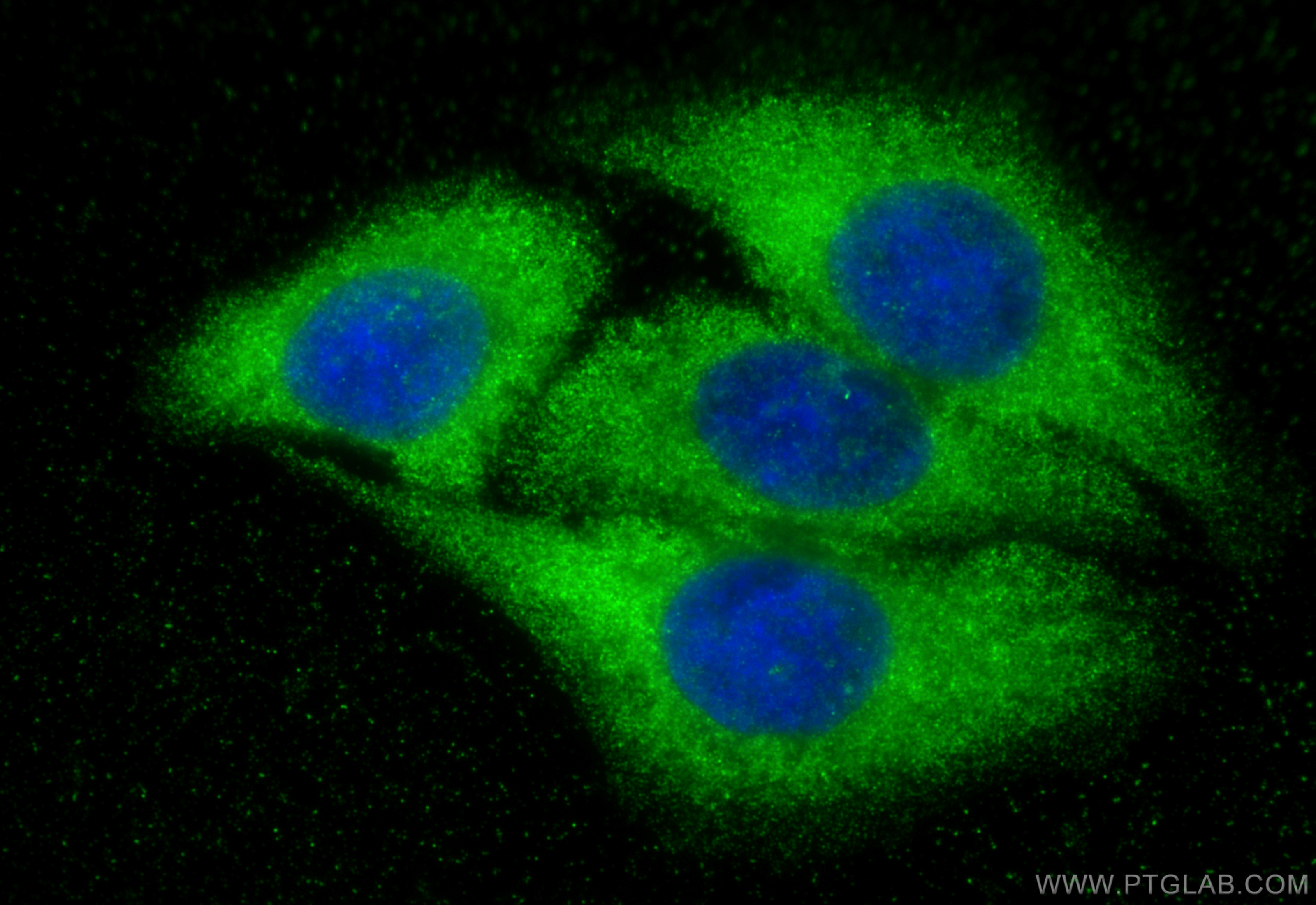 Immunofluorescence (IF) / fluorescent staining of HepG2 cells using CYP7A1 Polyclonal antibody (18054-1-AP)