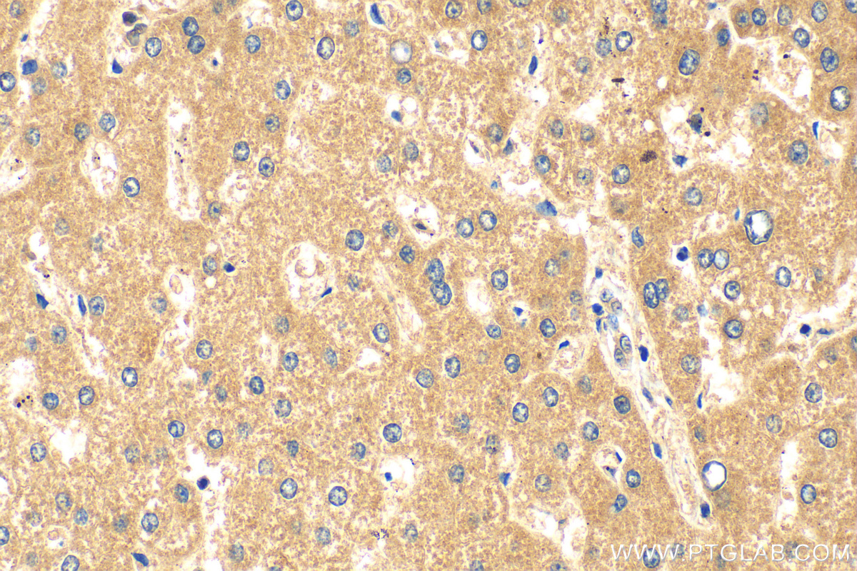 Immunohistochemistry (IHC) staining of human liver tissue using CYP7A1 Polyclonal antibody (18054-1-AP)