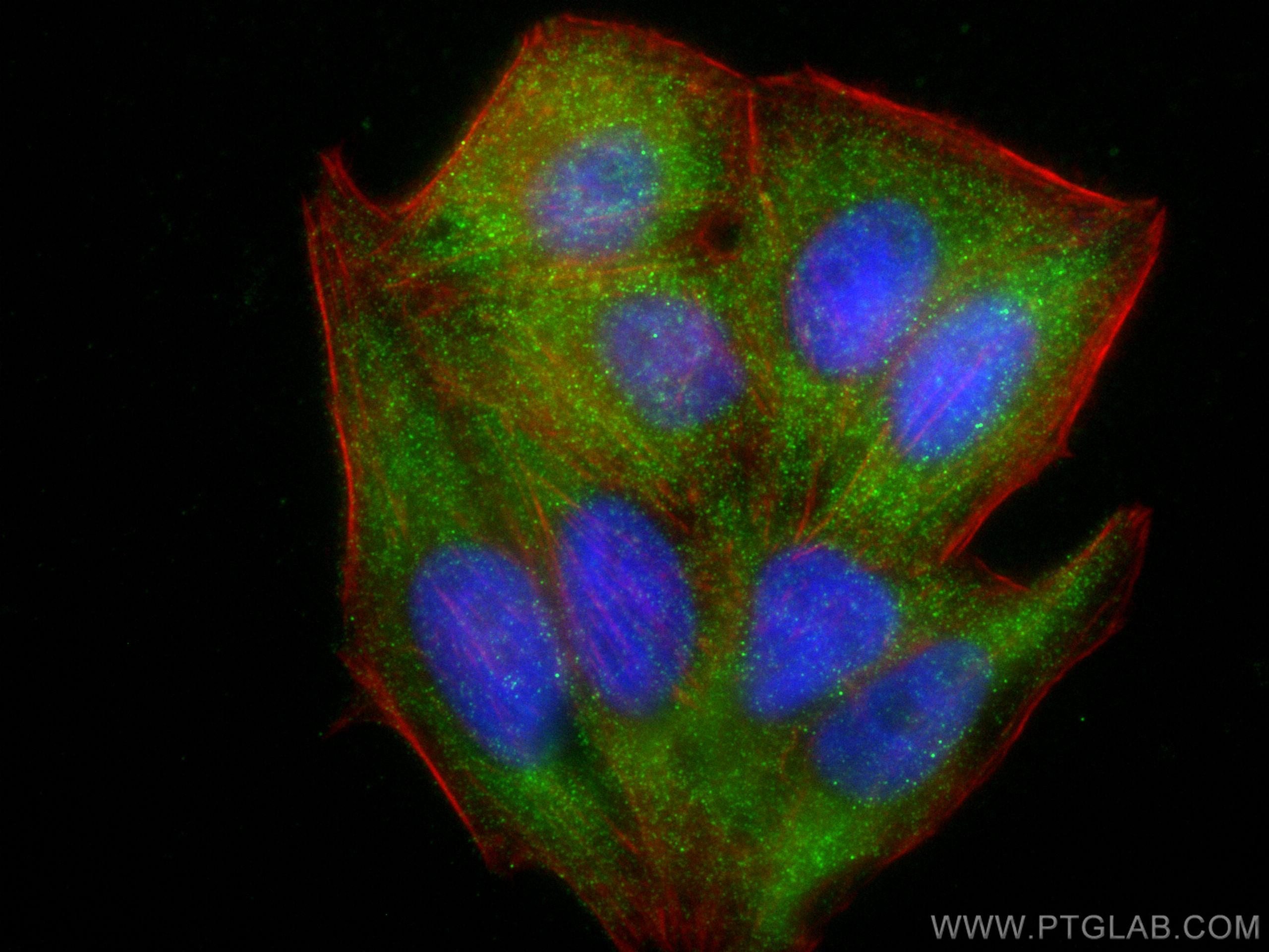 Immunofluorescence (IF) / fluorescent staining of HepG2 cells using CYP7B1 Recombinant antibody (82927-1-RR)