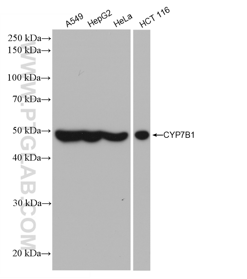 Western Blot (WB) analysis of various lysates using CYP7B1 Recombinant antibody (82927-1-RR)