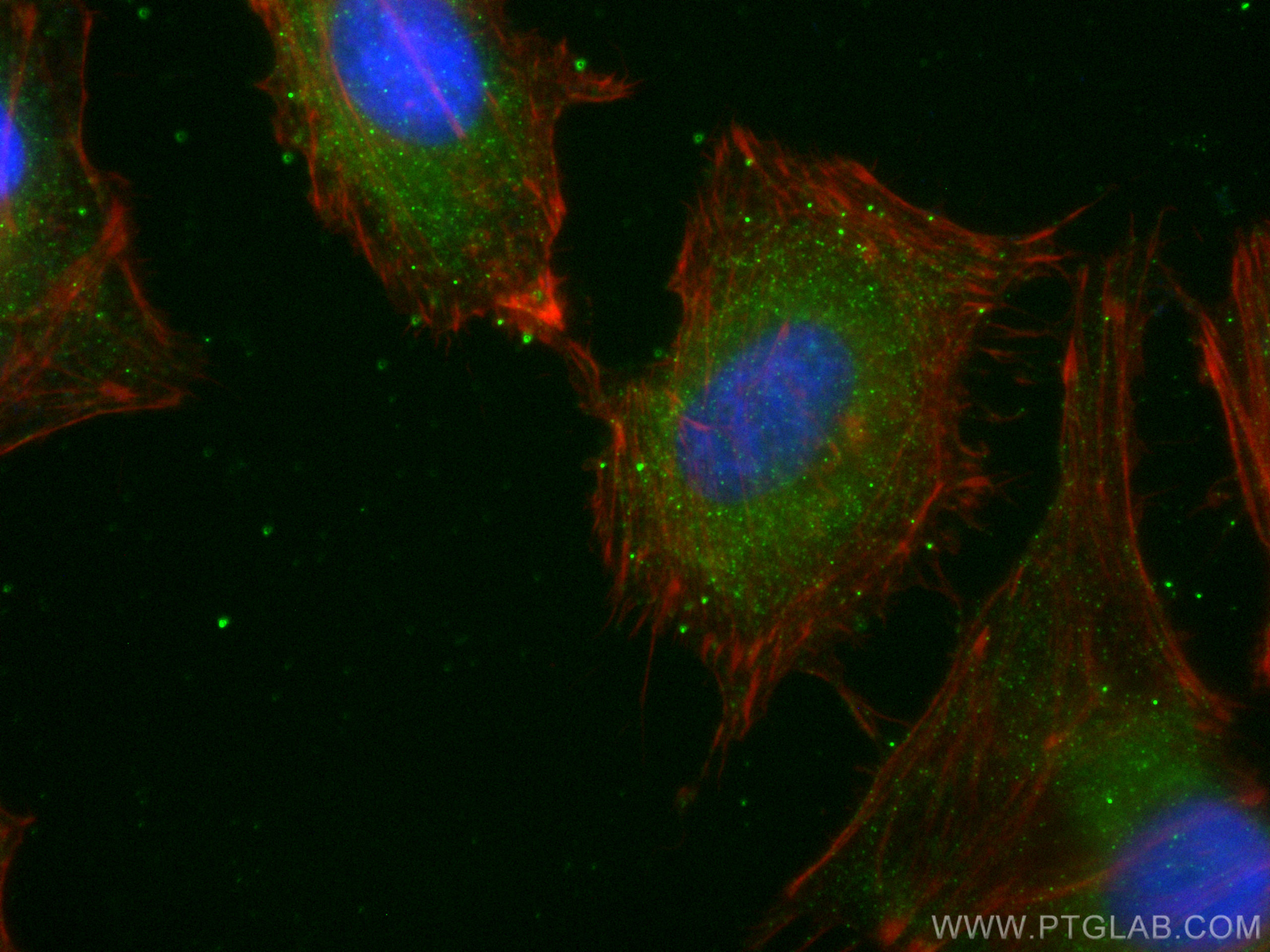 Immunofluorescence (IF) / fluorescent staining of HeLa cells using CYP7B1 Recombinant antibody (82927-2-RR)