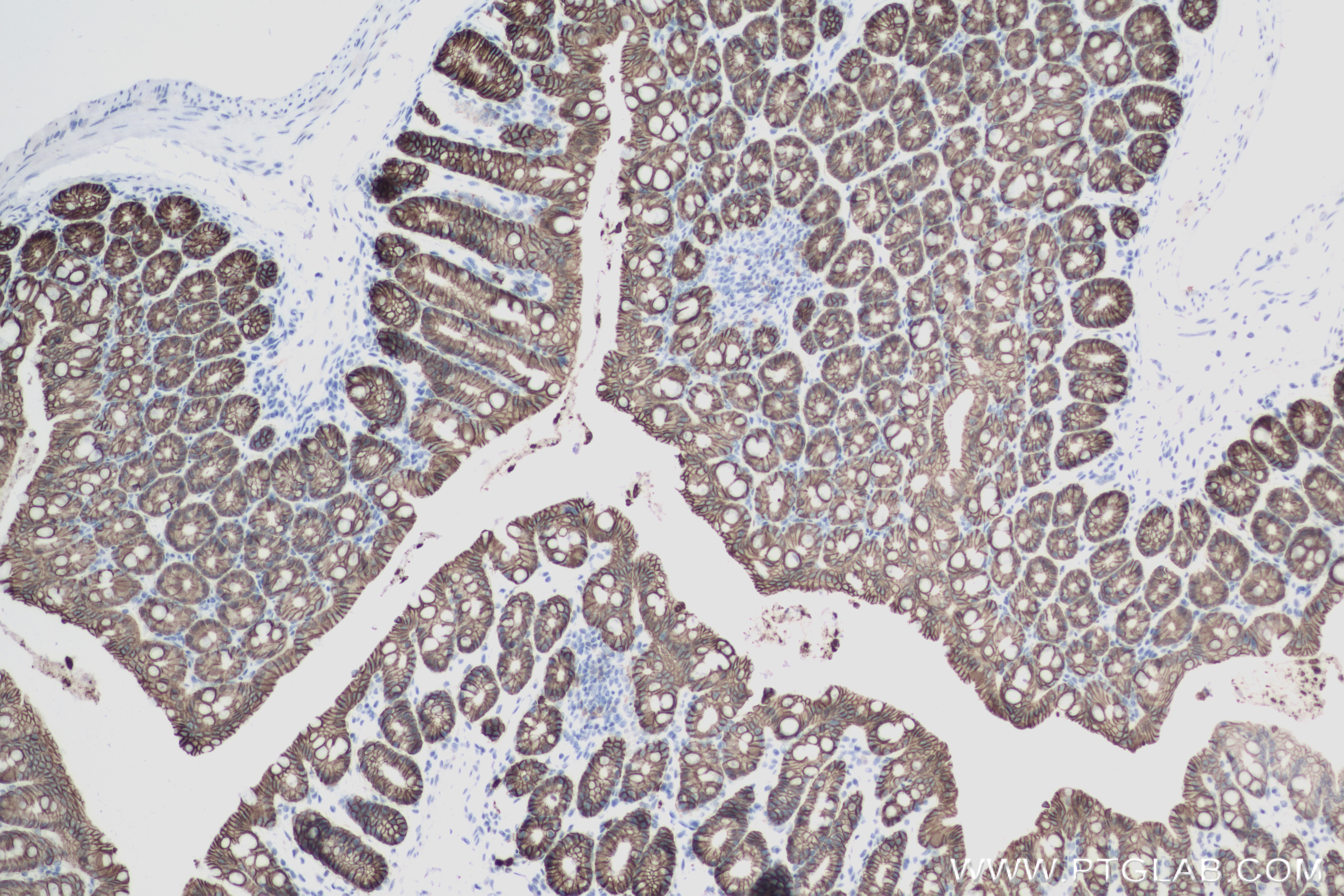 Immunohistochemistry (IHC) staining of mouse colon tissue using Cadherin-17 Recombinant antibody (83793-5-RR)