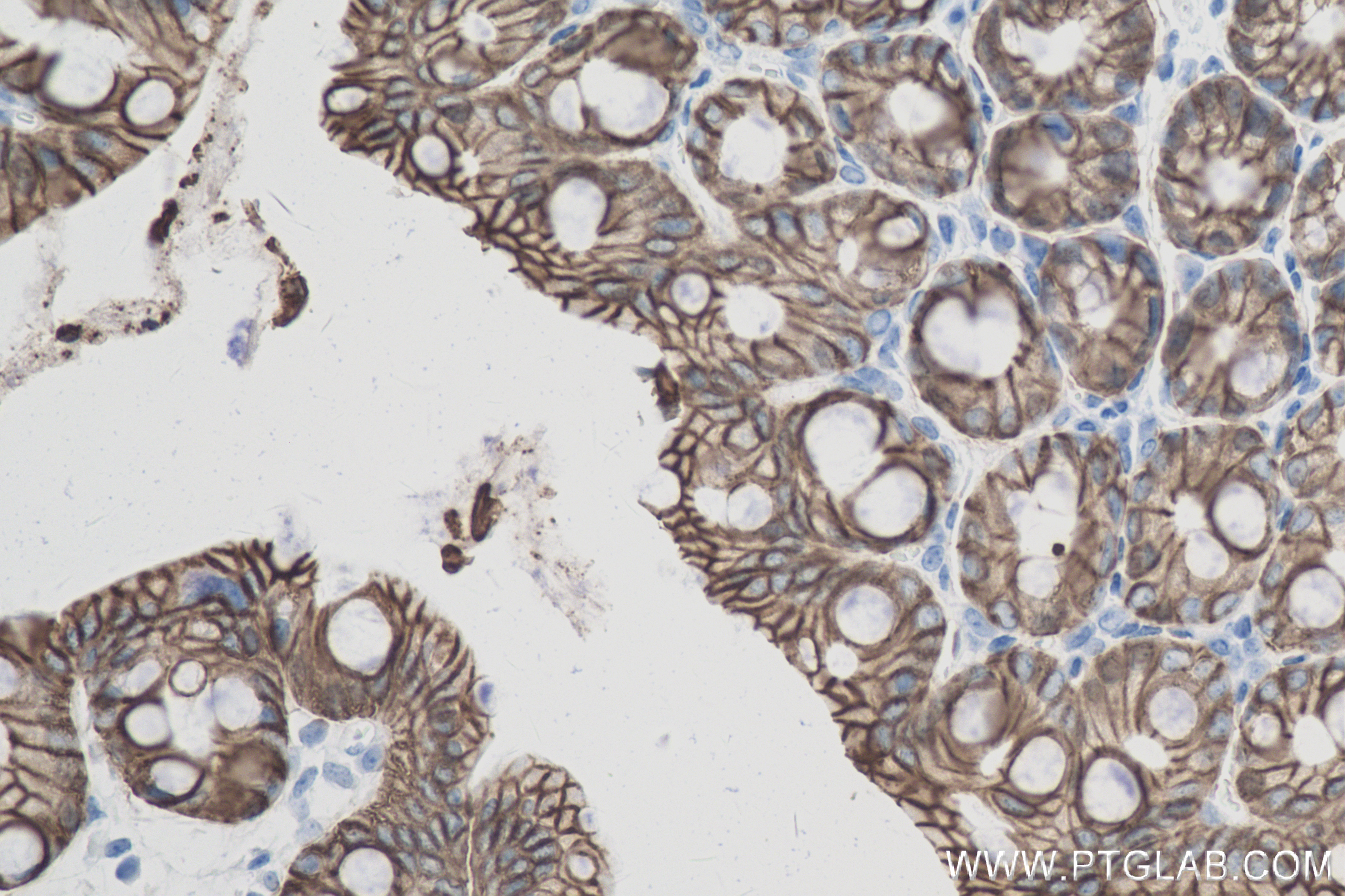 Immunohistochemistry (IHC) staining of mouse colon tissue using Cadherin-17 Recombinant antibody (83793-5-RR)