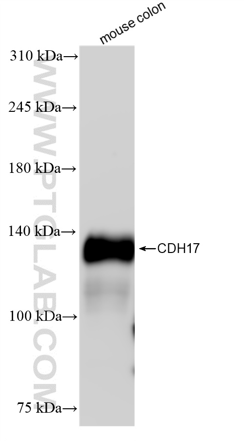 Western Blot (WB) analysis of mouse colon tissue using Cadherin-17 Recombinant antibody (83793-5-RR)