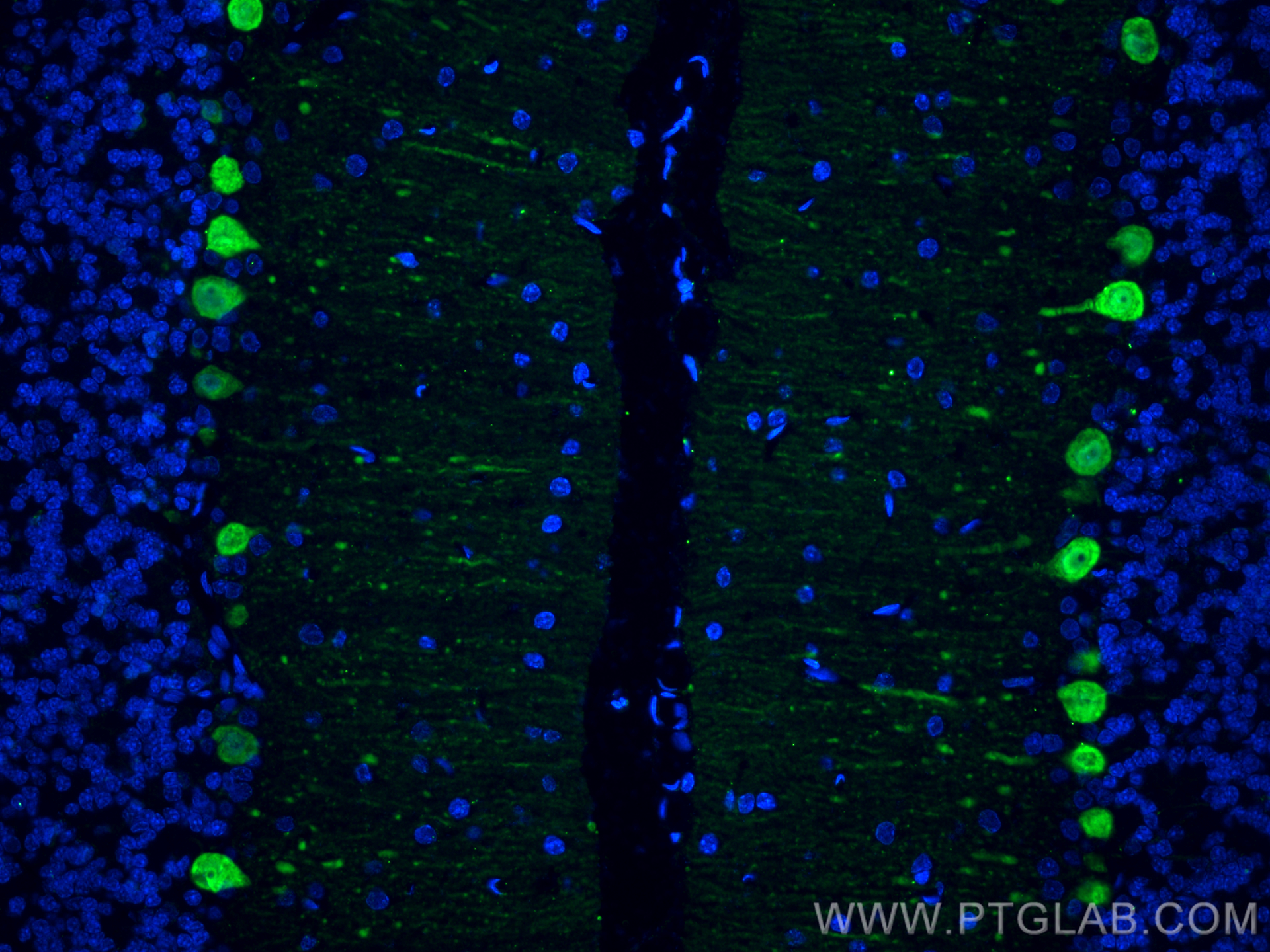 Immunofluorescence (IF) / fluorescent staining of rat cerebellum tissue using Calbindin-D28k Monoclonal antibody (66394-1-Ig)