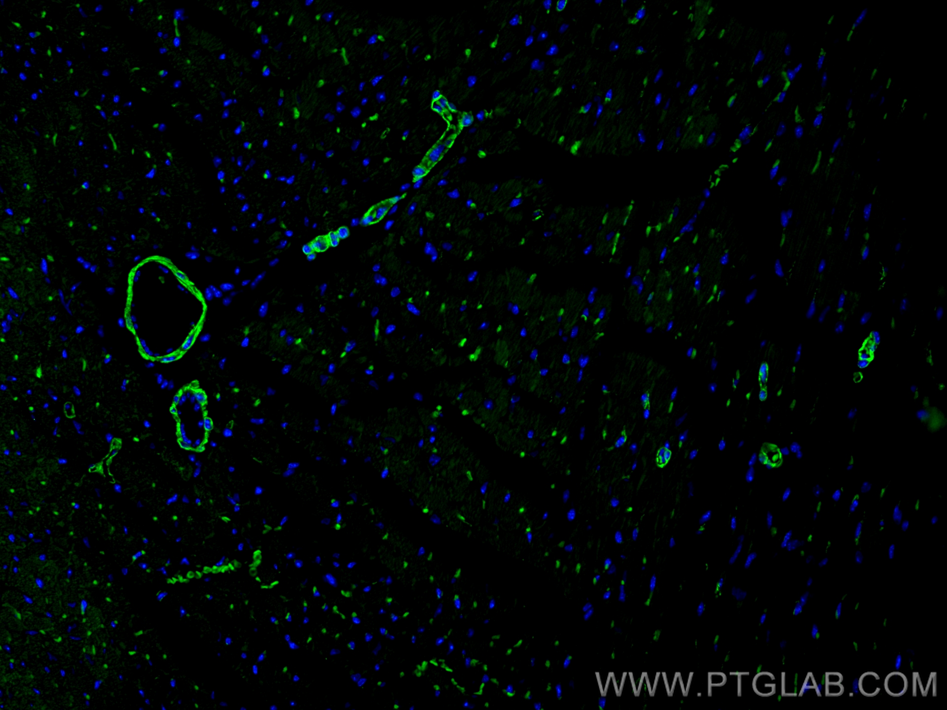 Immunofluorescence (IF) / fluorescent staining of mouse heart tissue using CoraLite® Plus 488-conjugated Caldesmon Polyclonal (CL488-20887)
