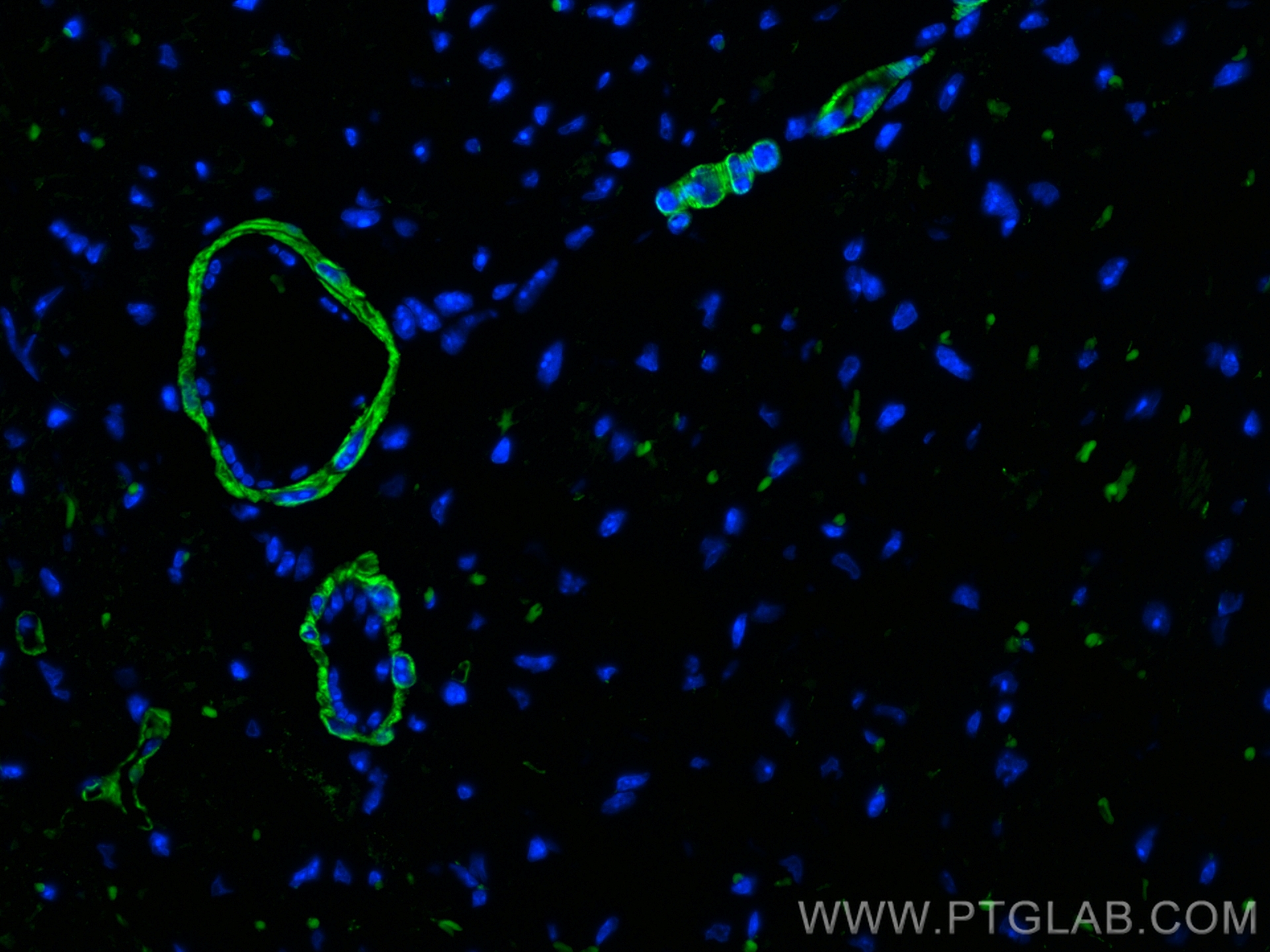 Immunofluorescence (IF) / fluorescent staining of mouse heart tissue using CoraLite® Plus 488-conjugated Caldesmon Polyclonal (CL488-20887)