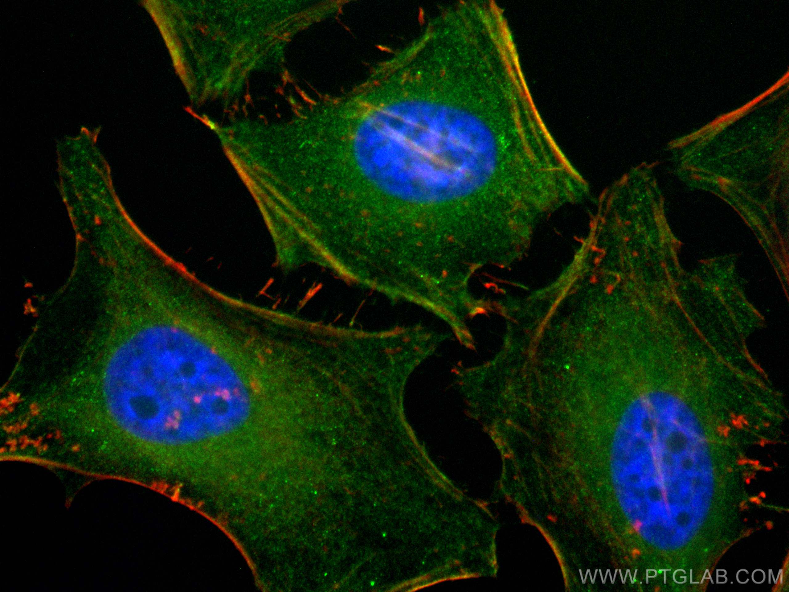 Immunofluorescence (IF) / fluorescent staining of HeLa cells using CoraLite® Plus 488-conjugated Caldesmon Polyclonal (CL488-20887)
