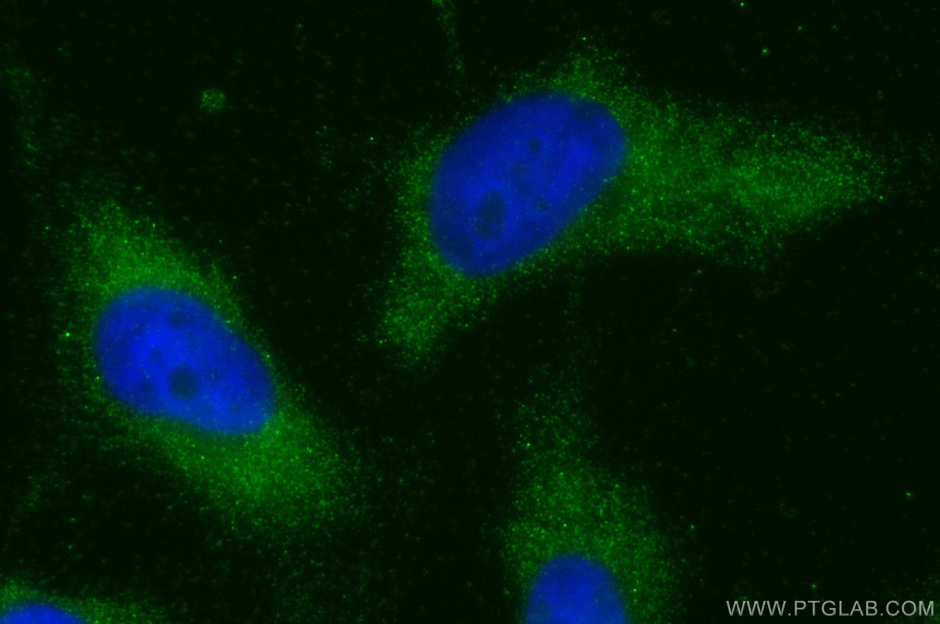 Immunofluorescence (IF) / fluorescent staining of HeLa cells using Calmodulin 1/2/3 Polyclonal antibody (28270-1-AP)