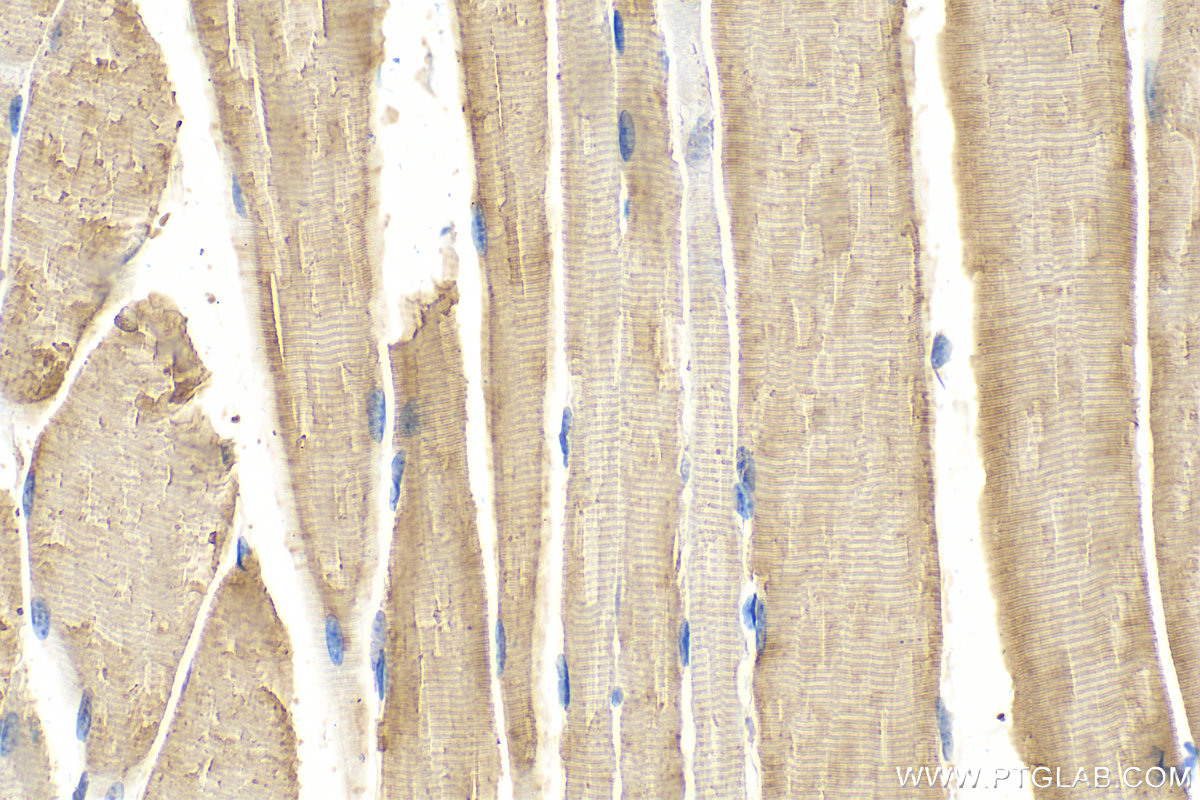Immunohistochemistry (IHC) staining of mouse skeletal muscle tissue using Calmodulin 1/2/3 Polyclonal antibody (28270-1-AP)