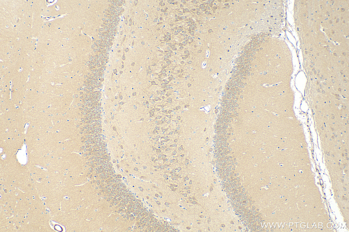 Immunohistochemistry (IHC) staining of rat brain tissue using Calmodulin 1/2/3 Polyclonal antibody (28270-1-AP)