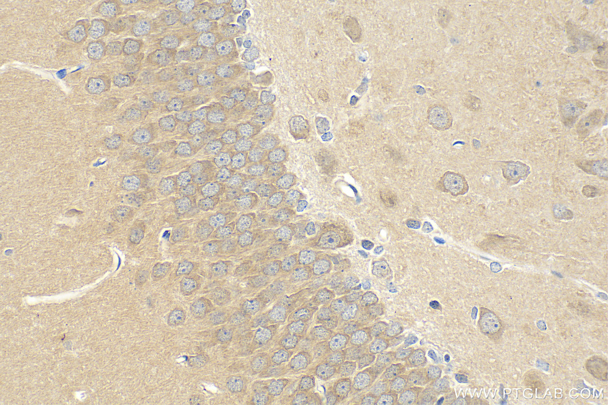 Immunohistochemistry (IHC) staining of rat brain tissue using Calmodulin 1/2/3 Polyclonal antibody (28270-1-AP)