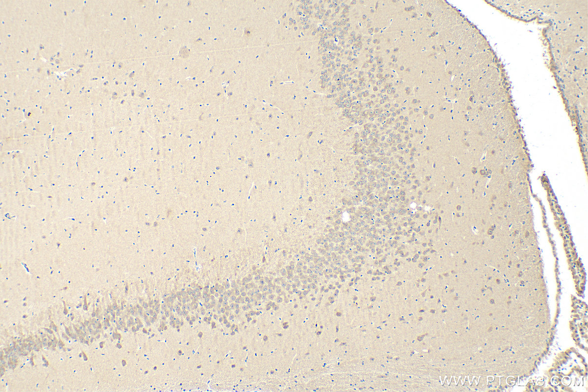 Immunohistochemistry (IHC) staining of mouse brain tissue using Calmodulin 1/2/3 Polyclonal antibody (28270-1-AP)