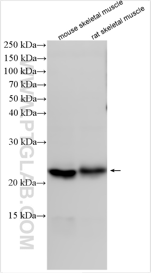 Western Blot (WB) analysis of various lysates using Calmodulin 1/2/3 Polyclonal antibody (28270-1-AP)