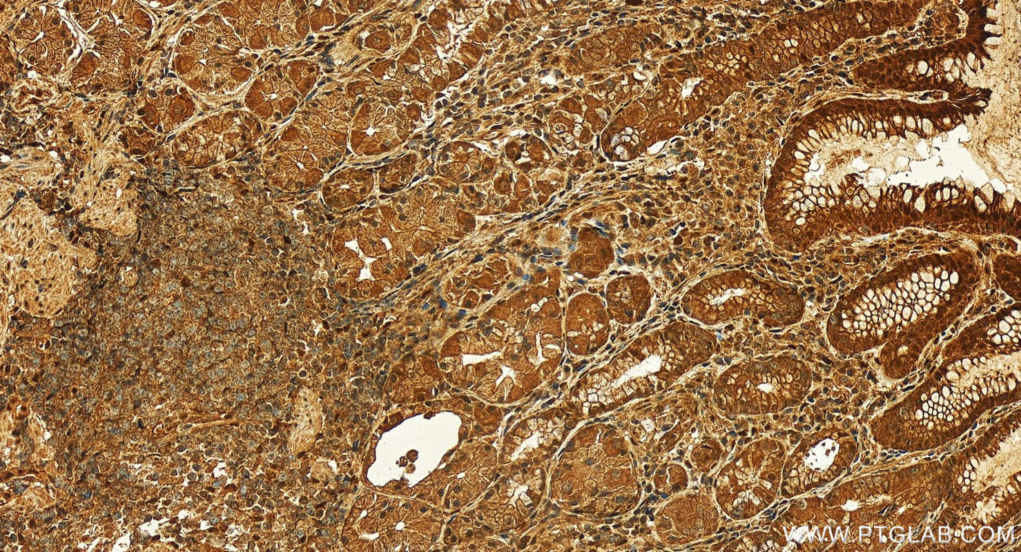 Immunohistochemistry (IHC) staining of human stomach tissue using Calpain 7 Polyclonal antibody (26985-1-AP)