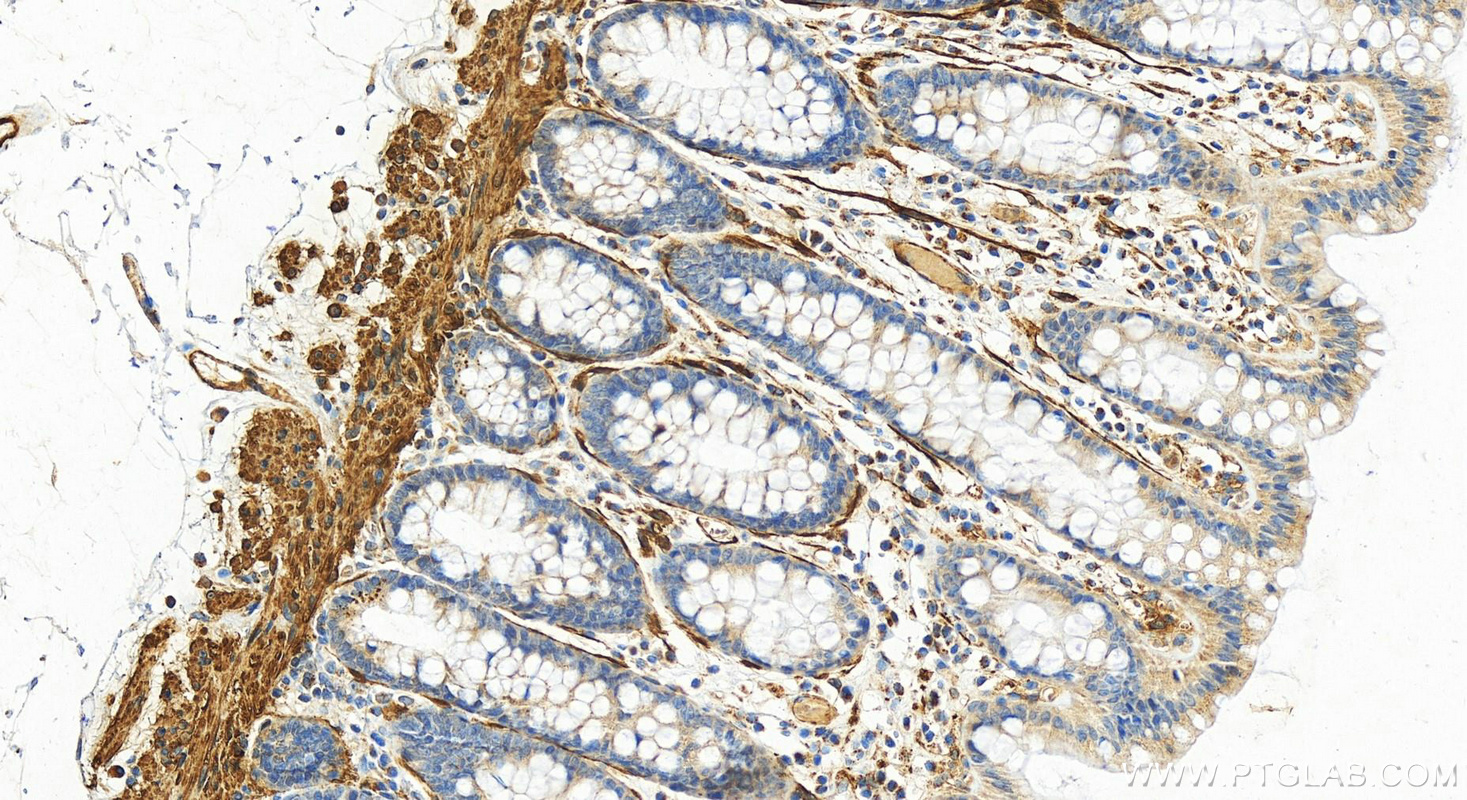 Immunohistochemistry (IHC) staining of human colon tissue using Calponin Polyclonal antibody (24855-1-AP)