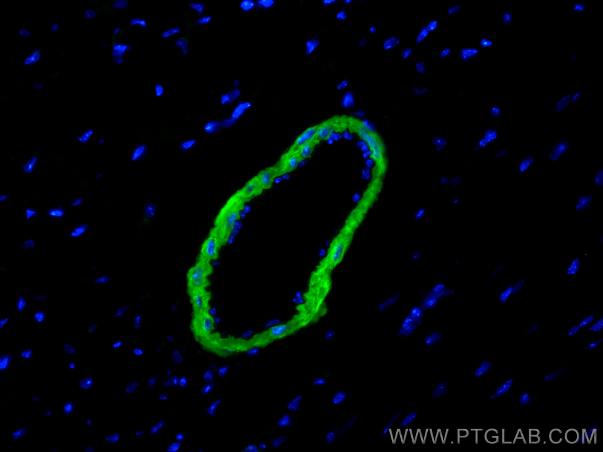 Immunofluorescence (IF) / fluorescent staining of mouse heart tissue using CoraLite® Plus 488-conjugated Calponin Polyclonal  (CL488-13938)