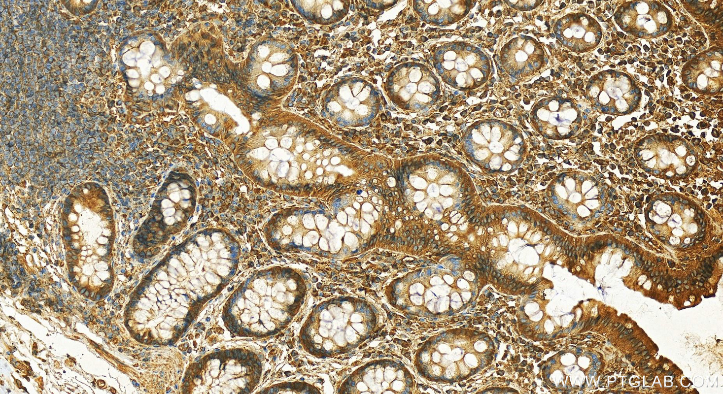 Immunohistochemistry (IHC) staining of human normal colon using calreticulin Polyclonal antibody (27298-1-AP)