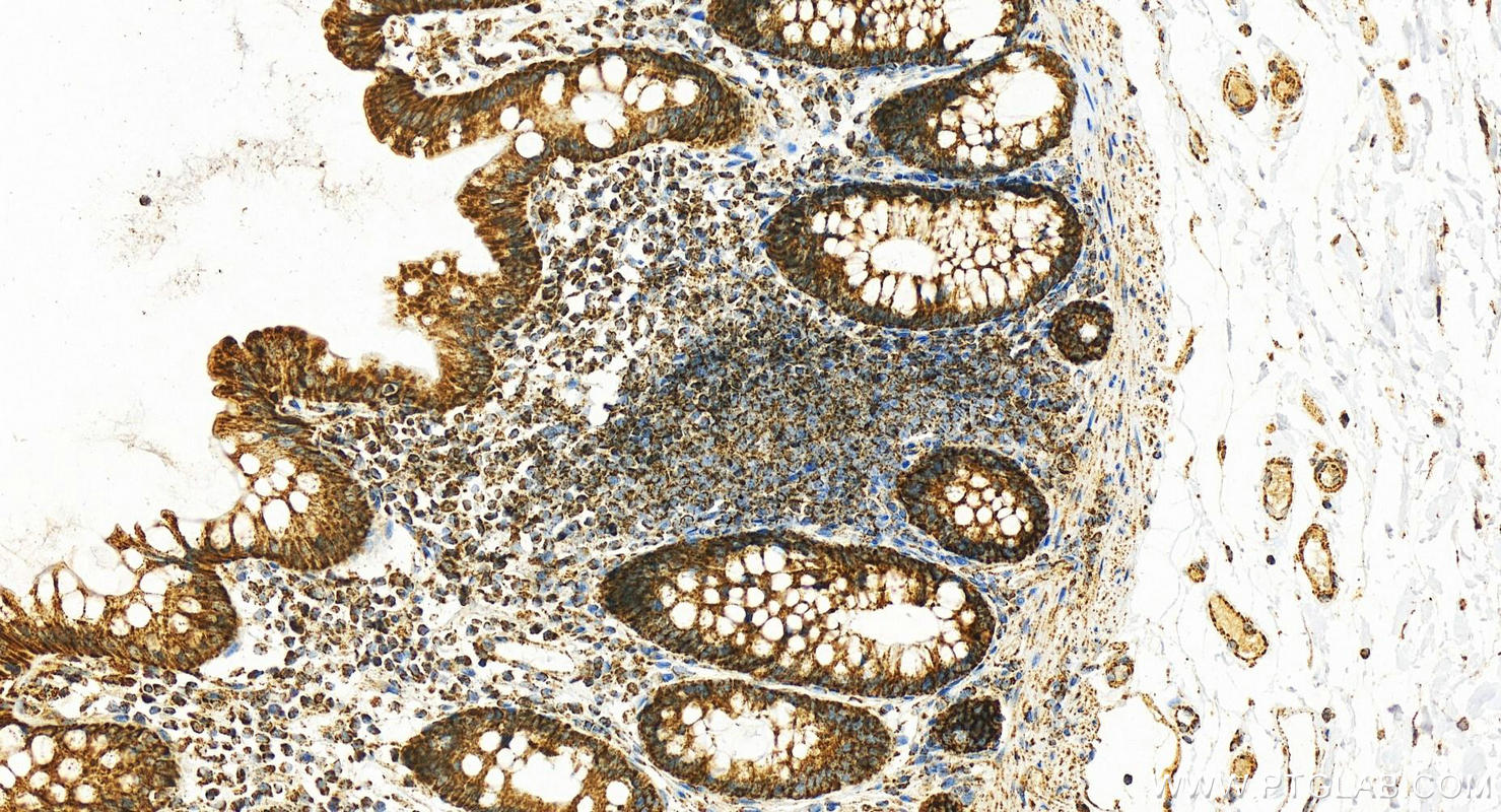 Immunohistochemistry (IHC) staining of human normal colon using calreticulin Polyclonal antibody (27298-1-AP)